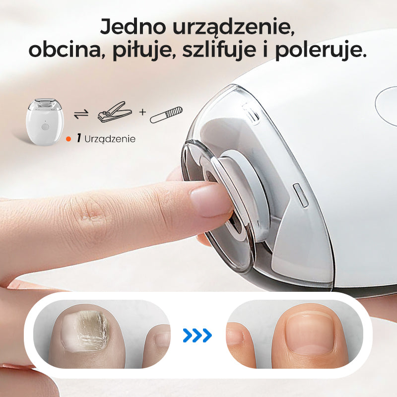 🎉 Elektryczny obcinacz do paznokci - Bezpieczny, nie uszkodzi skóry