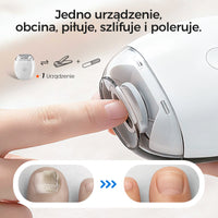 🎉 Elektryczny obcinacz do paznokci - Bezpieczny, nie uszkodzi skóry