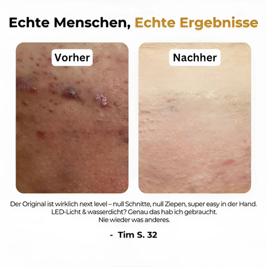 5-in-1 Haartrimmer für Männer
